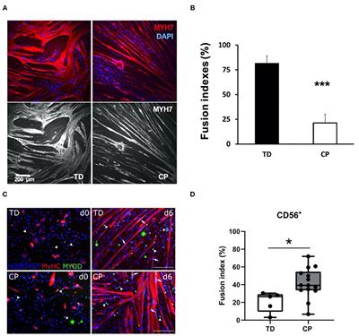 Commentary: Muscle Microbiopsy to Delineate Stem Cell Involvement in Young Patients: A Novel Approach for Children With Cerebral Palsy